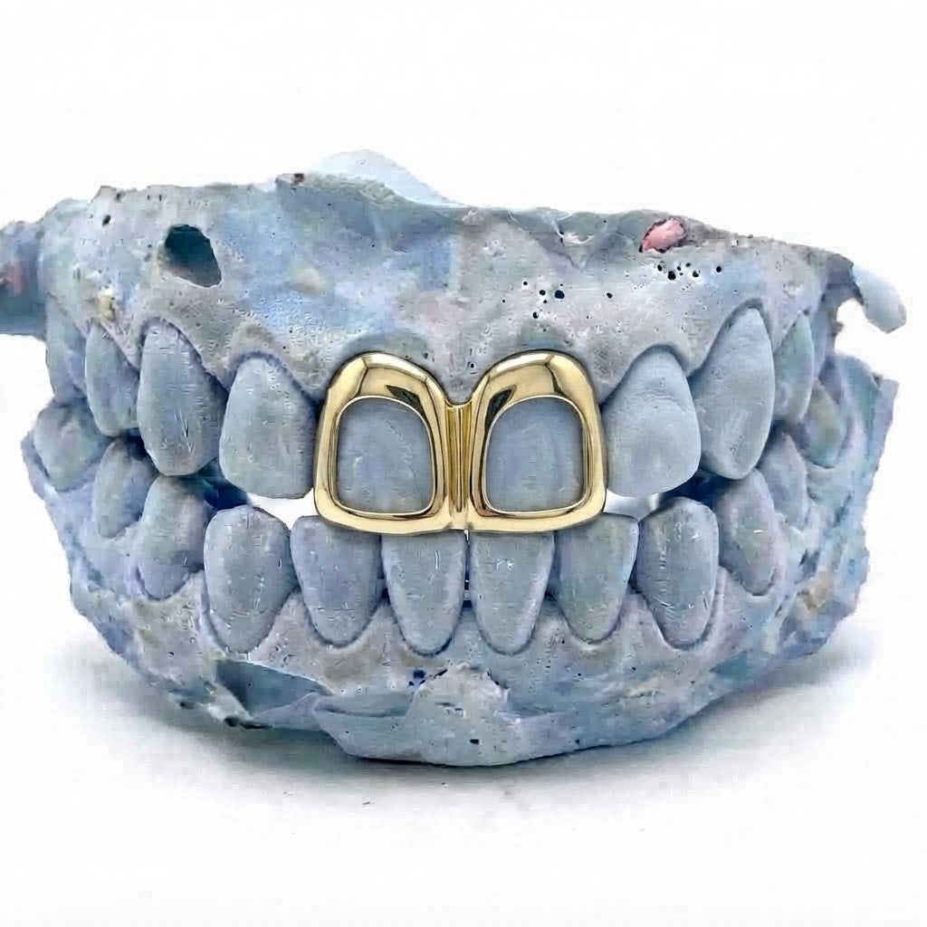 2er Cap Frame Gold Grillz oben V8 – 18 Karat vergoldete Grillz nach Maß von Z Juwelier