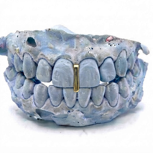 Single Cap - Gold Grillz Top - Gap Filler