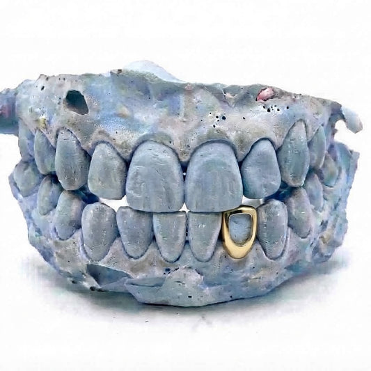 Single Cap - Gold Grillz Bottom - Open Face