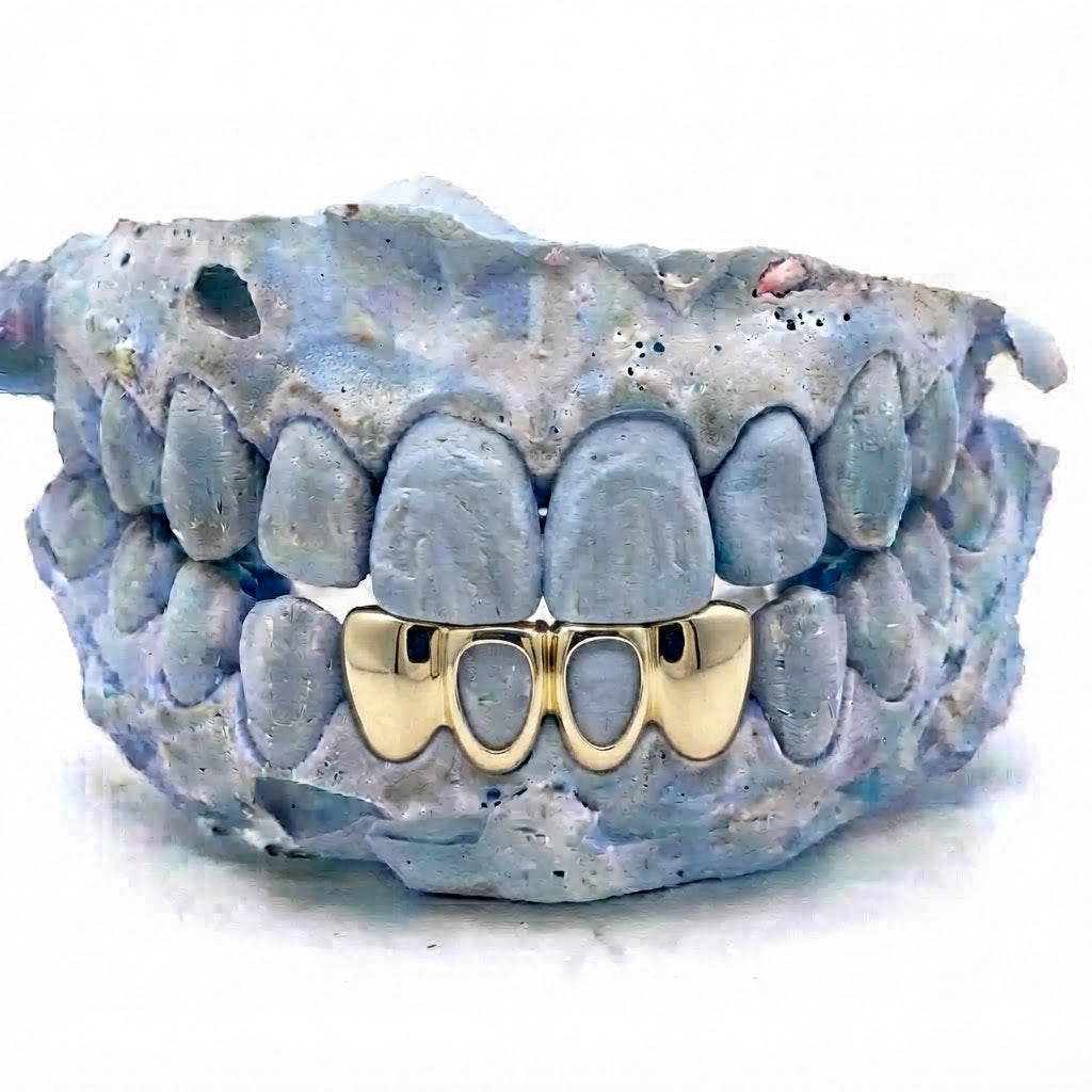 4er Cap Frame Gold Grillz unten V2 – 18 Karat vergoldete Grillz nach Maß von Z Juwelier