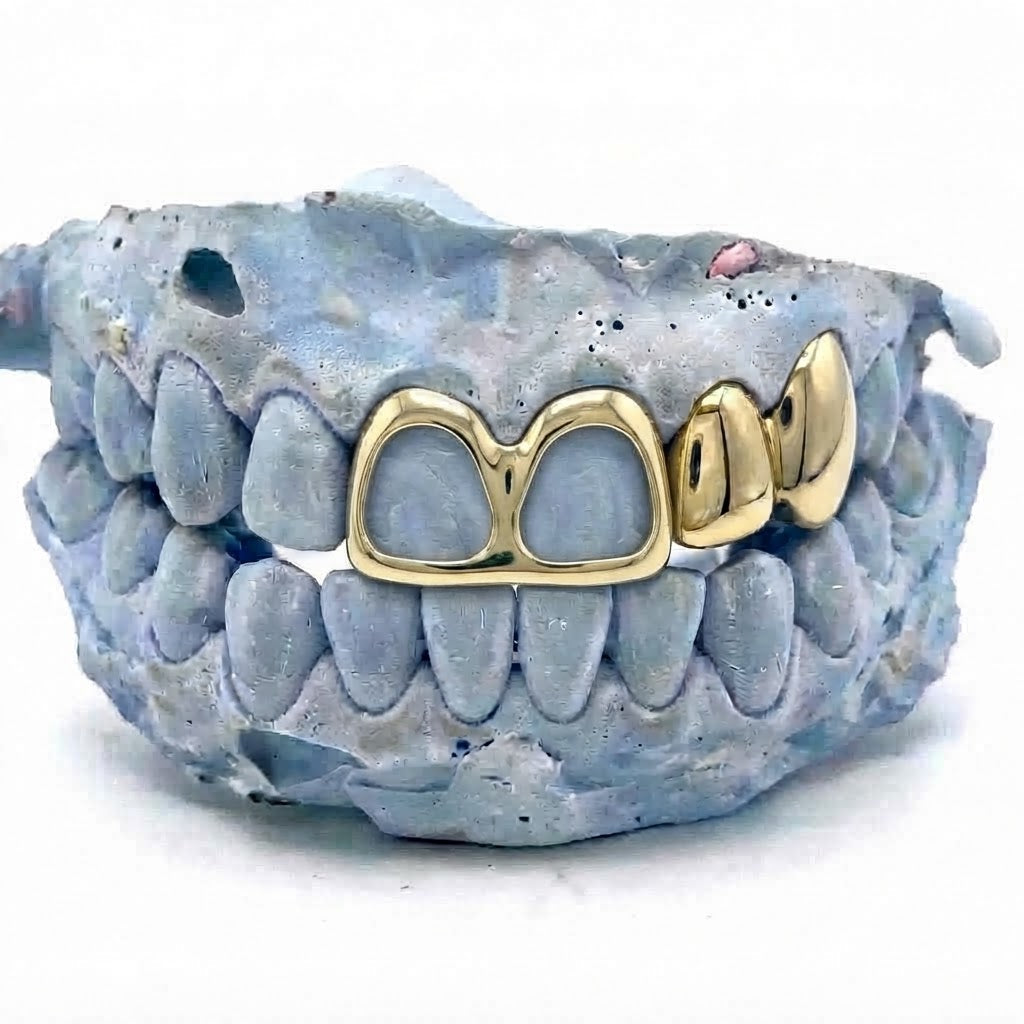 4er Cap Gold Grillz oben V8 – 18 Karat vergoldete Grillz nach Maß von Z Juwelier