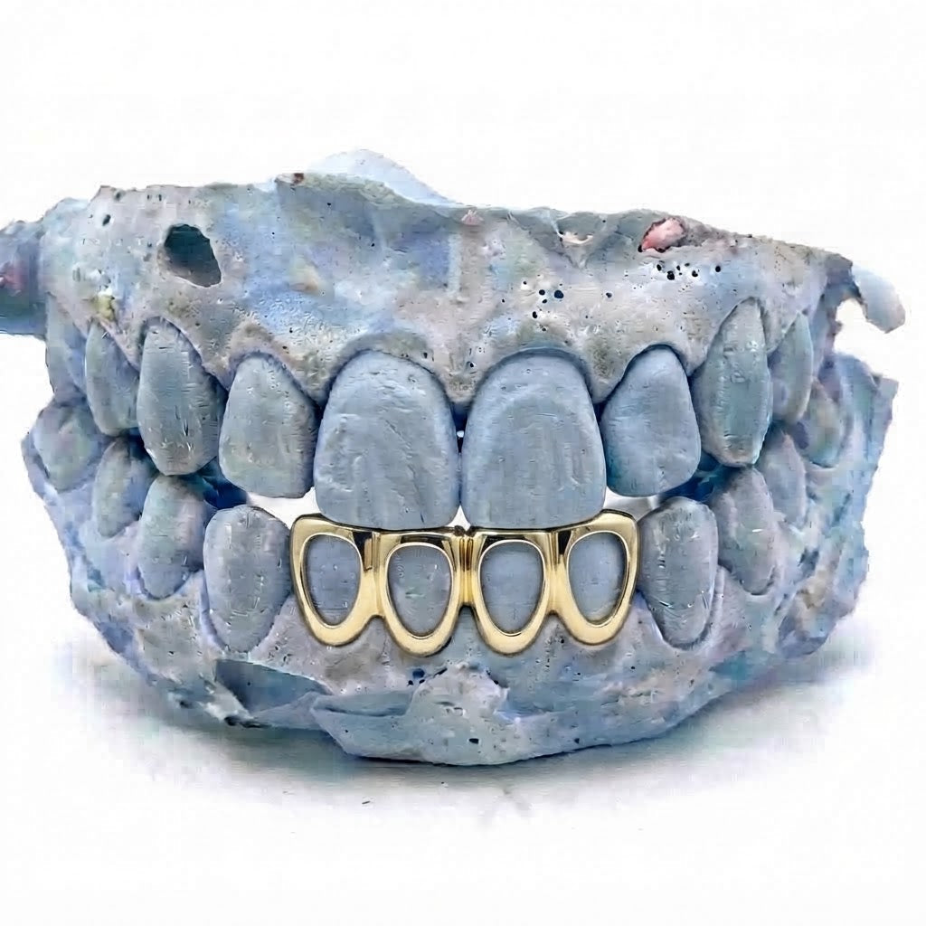 4er Cap Frame Gold Grillz unten V5 – 18 Karat vergoldete Grillz nach Maß von Z Juwelier