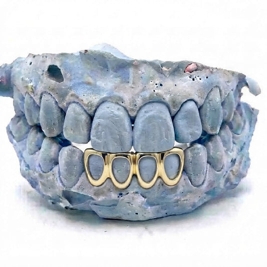 4er Cap Frame Echtgold Grillz unten V3 aus massivem 14 Karat Echtgold (585) – Grillz nach Maß von Z Juwelier