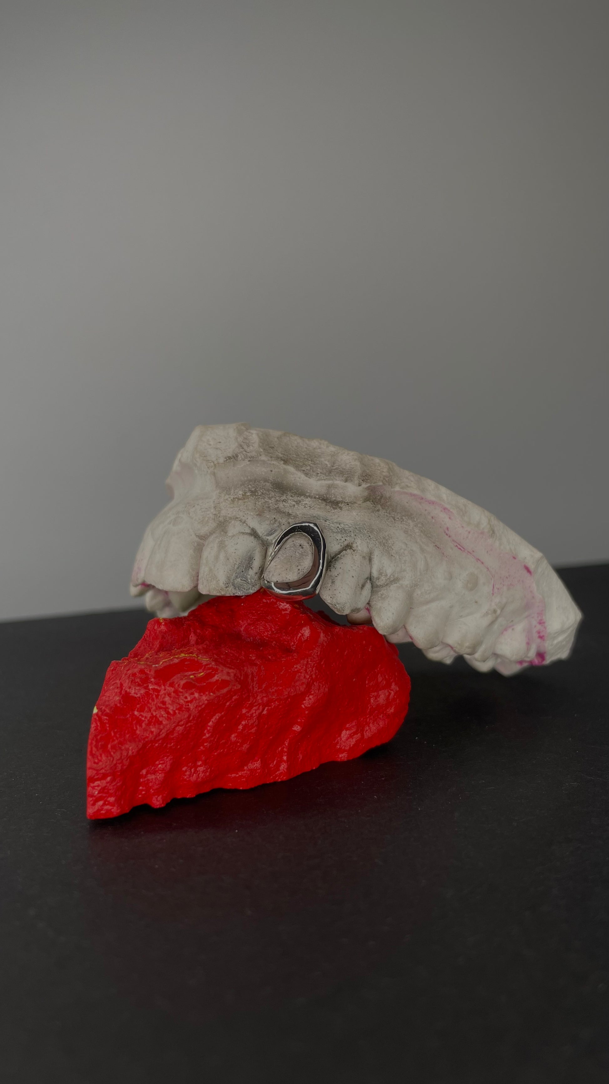 Single Frame Cap Grillz – Offenes leichtes Design von ZGrillz 
custom frame dezent 