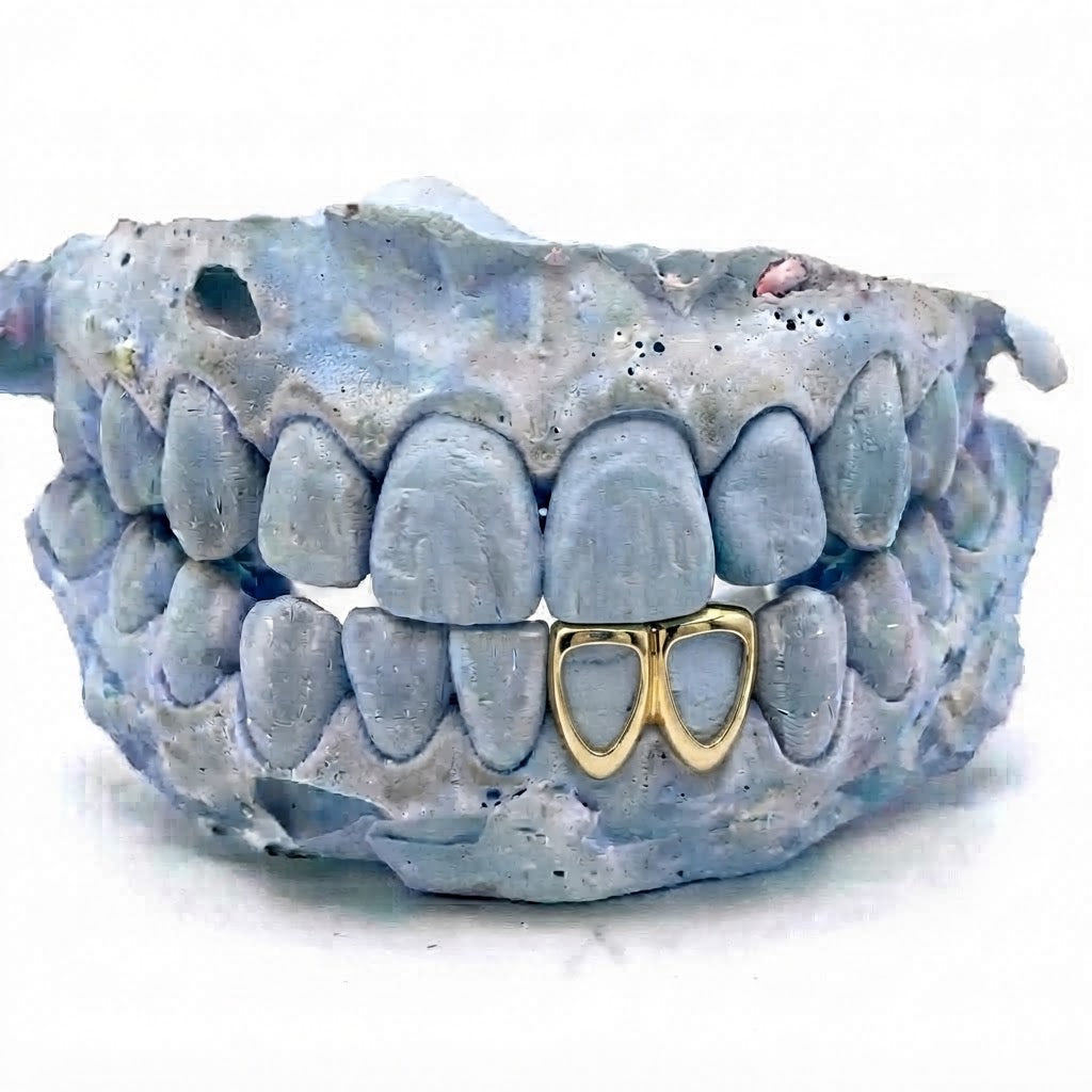 2er Cap Frame Gold Grillz unten V4 – 18 Karat vergoldete Grillz nach Maß von Z Juwelier