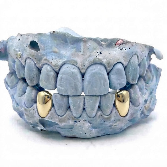 2er Cap Echtgold Grillz unten aus massivem 14 Karat Echtgold (585) – Grillz nach Maß von Z Juwelier