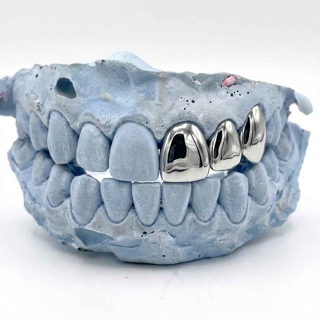 Silver Grillz oben 3er Cap auf Zahn 21 bis 23 – Grillz aus Chrom, Custom Grillz für deine Zähne nach Maß