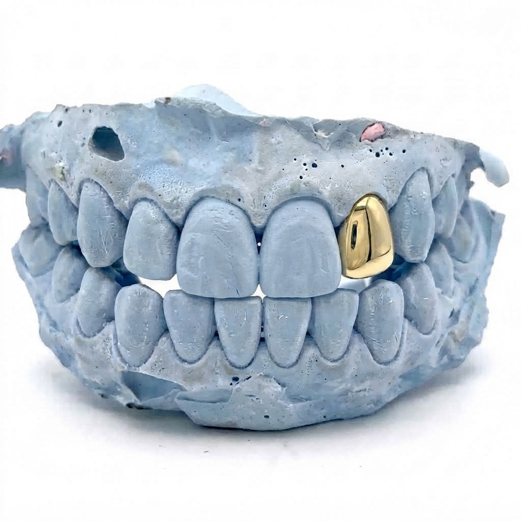 Single Cap - Gold Grillz Top