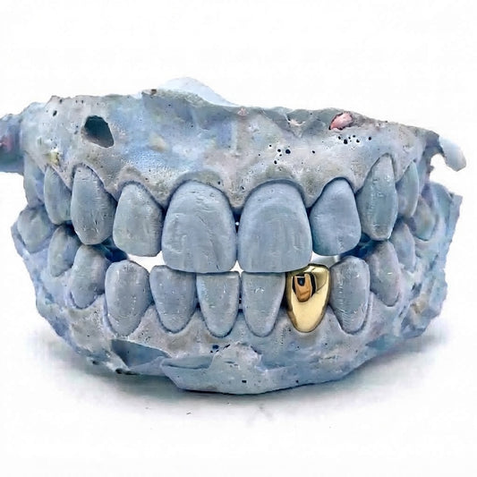 Single Cap - Gold Grillz Bottom