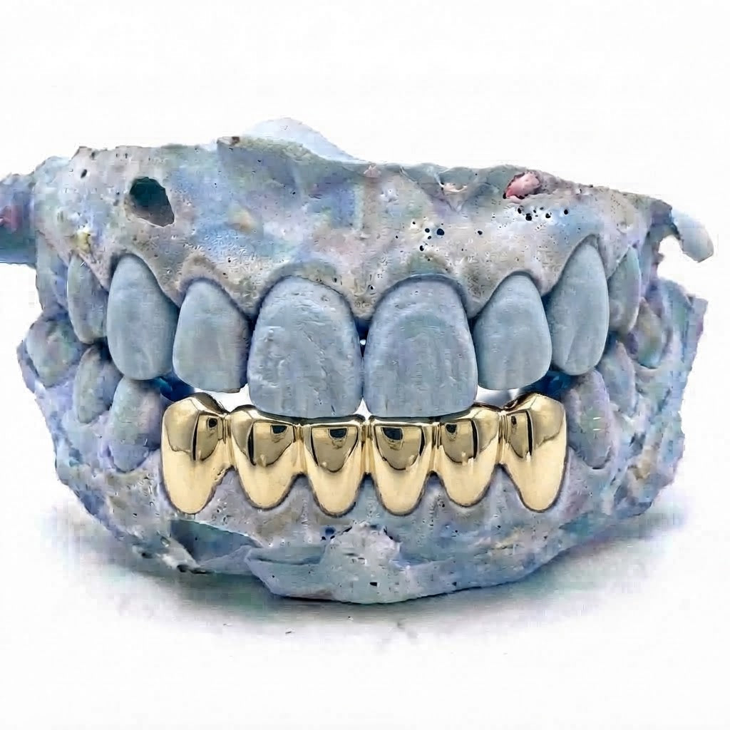 Gold Grillz unten – 6er Reihe – 18 Karat vergoldete Grillz nach Maß von Z Juwelier