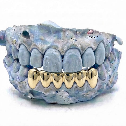 Echtgold Grillz unten – 6er Reihe aus massivem 14 Karat Echtgold (585) – Grillz nach Maß von Z Juwelier