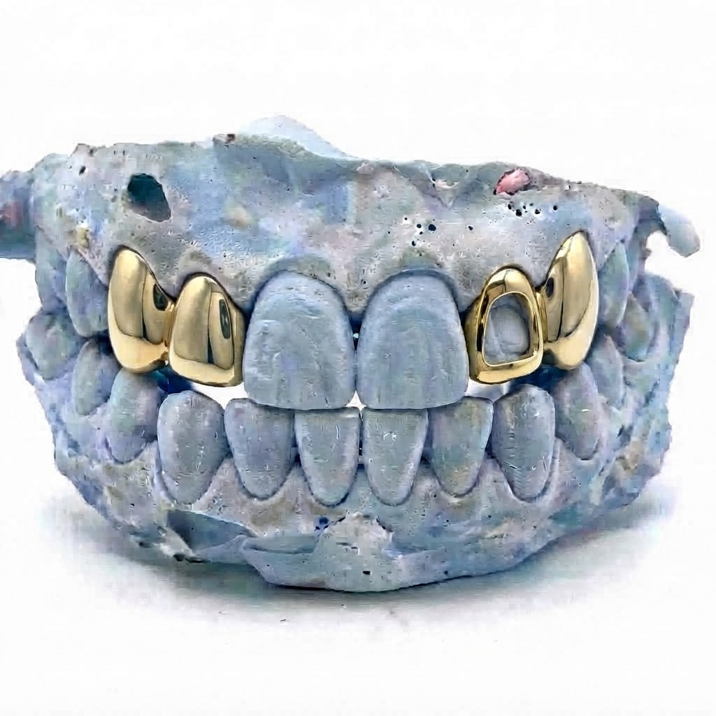 4er Cap Gold Grillz oben V7 – 18 Karat vergoldete Grillz nach Maß von Z Juwelier