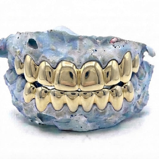 Echtgold Grillz Top & Bottom 8er/8er aus massivem 14 Karat Echtgold (585) – Grillz nach Maß von Z Juwelier