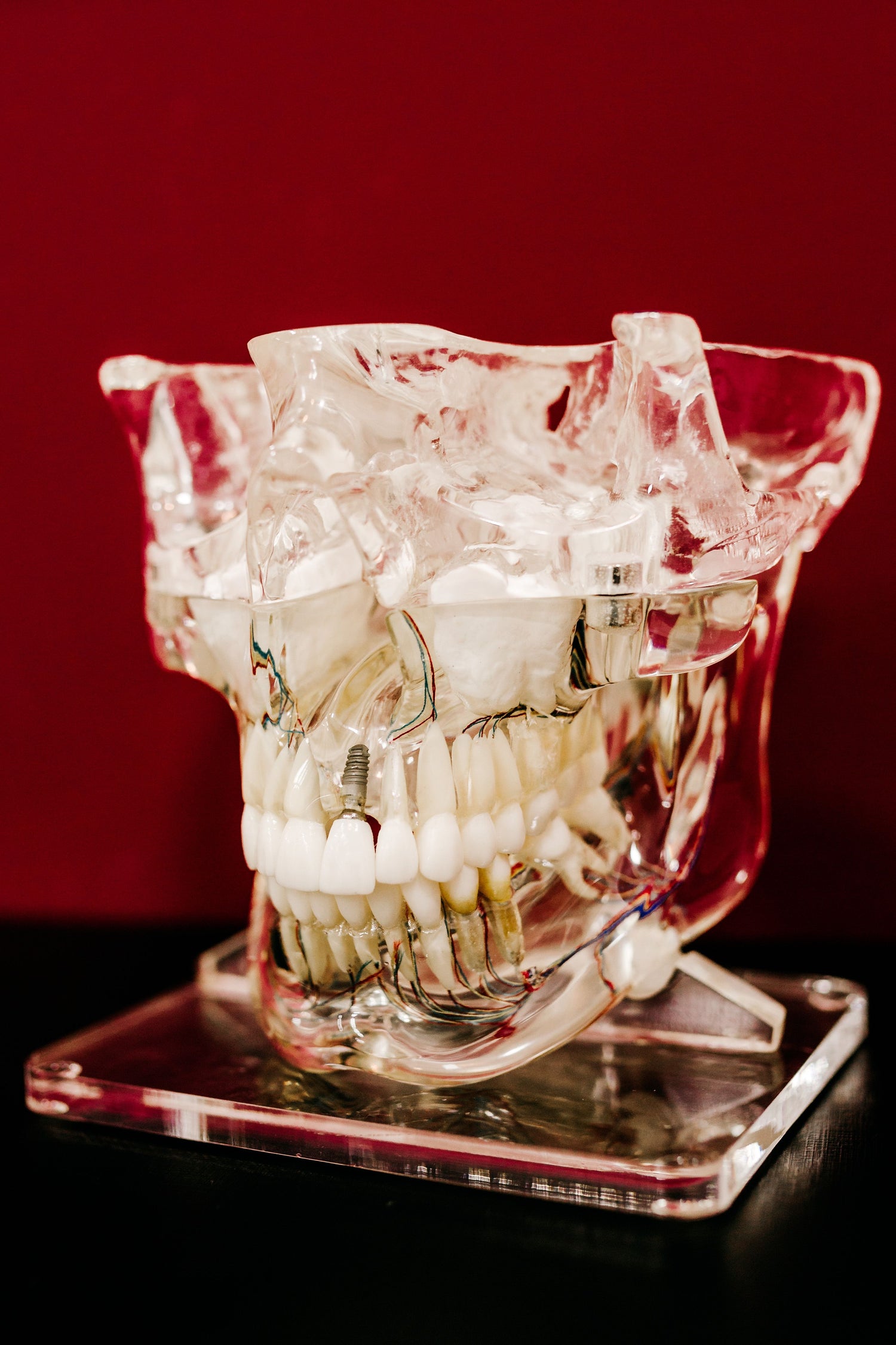 kiefer grillz gold 14k